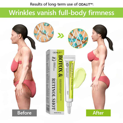 [🔥Last Day 70% OFF] ODALIT™ Botox & Retinol Shot - Eraser for Deep Wrinkles, Sagging Jowls & Puffy Eyes