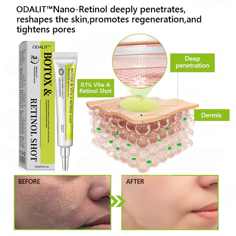 [🔥Last Day 70% OFF] ODALIT™ Botox & Retinol Shot - Eraser for Deep Wrinkles, Sagging Jowls & Puffy Eyes