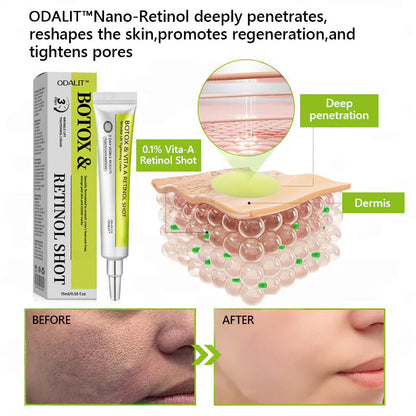[🔥Last Day 70% OFF] ODALIT™ Botox & Retinol Shot - Eraser for Deep Wrinkles, Sagging Jowls & Puffy Eyes