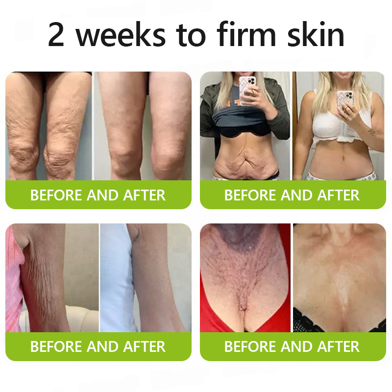 [🔥Last Day 70% OFF] ODALIT™ Botox & Retinol Shot - Eraser for Deep Wrinkles, Sagging Jowls & Puffy Eyes