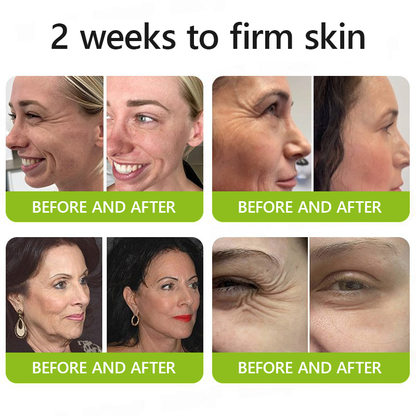 [🔥Last Day 70% OFF] ODALIT™ Botox & Retinol Shot - Eraser for Deep Wrinkles, Sagging Jowls & Puffy Eyes